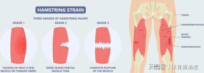  东契奇执意归国治伤的背后：当信任崩塌，职业球员该何去何从 情感心理